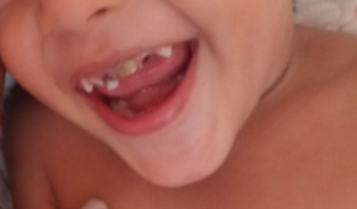 Dente 