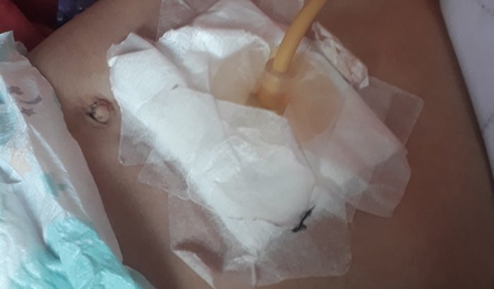 Daniel precisa urgente de medicacoes 