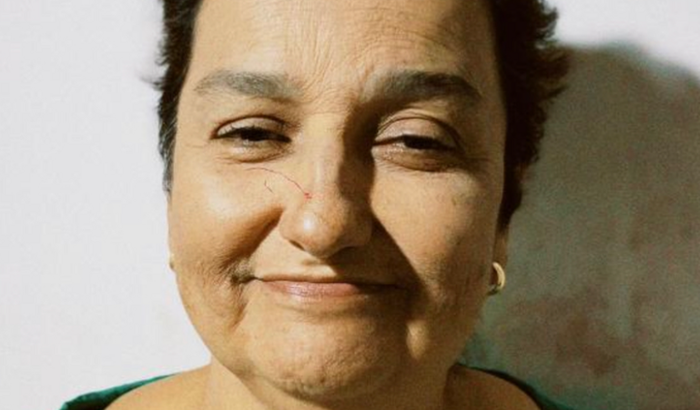 Ajuda para cirurgia de Ângela Maria