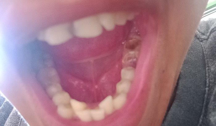Realizar cirurgias odontológica para realizar o sonho de fazer o concurso para PM