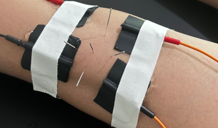  Sua ajuda ,vai me permitir voltar a jogar bola