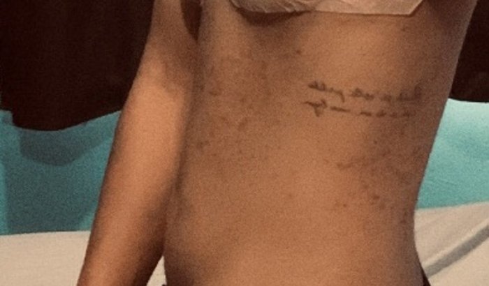 MASTECTOMIA DO LUCCA