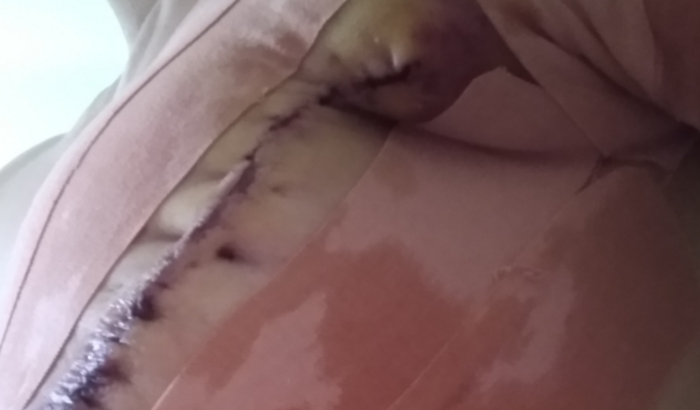 Ajuda no tratamento Daty