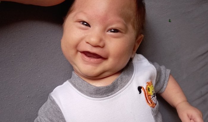 TODOS PELO DAVI, CRANIOSTENOSE TEM CURA, AJUDEM MEU MENINO A TER UMA VIDA SAUDÁVEL❤️‍🩹