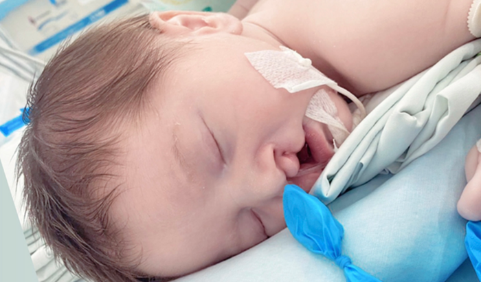 Fissurados por Lorenzo