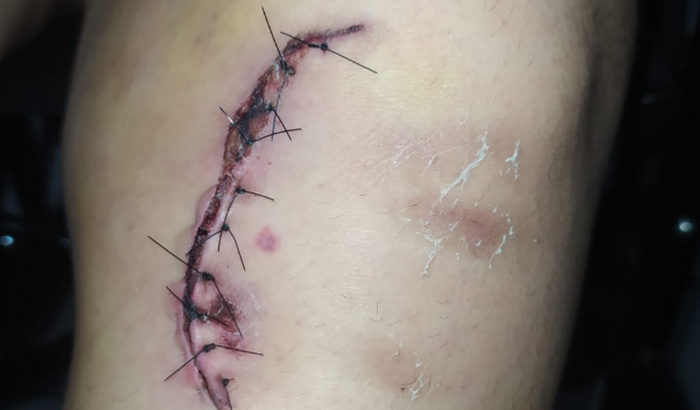 Ajuda para tirar minha moto do pátio