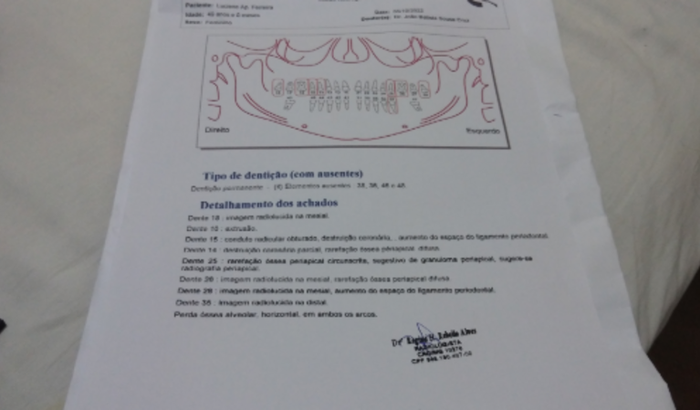 Tratamento De Canais Dentários e Prótese