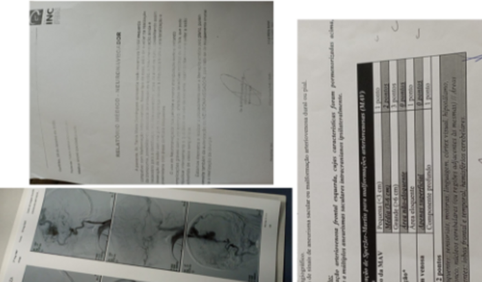 Neuronavegador para Tania