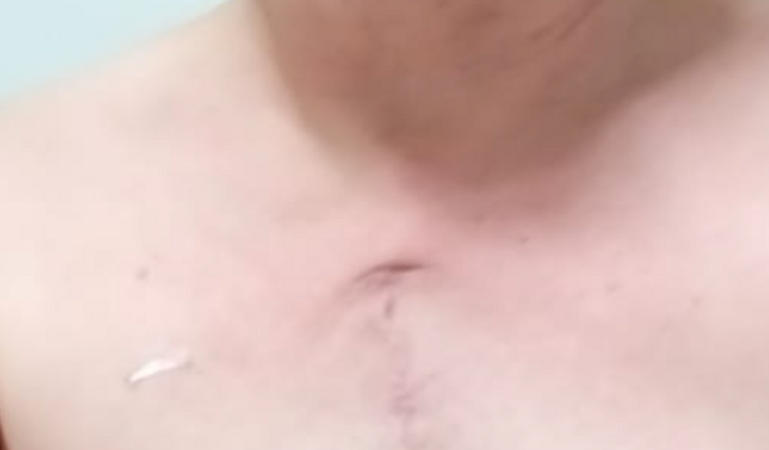 Ajuda ao meu irmão, que passou por uma cirurgia do coração ,e o seu ganha pão é sua profissão