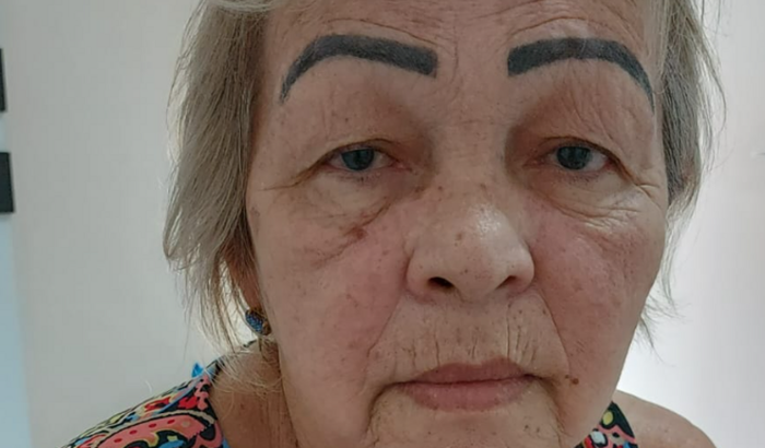 Em prol da visão da Dete