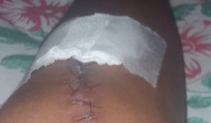 Fisioterapia 
