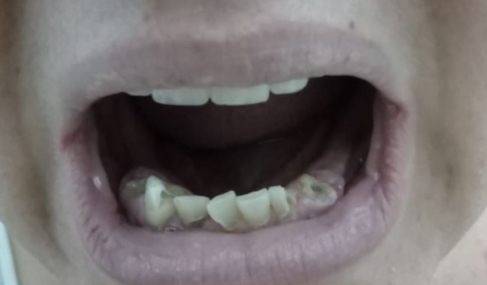 Tratamento Odontológico