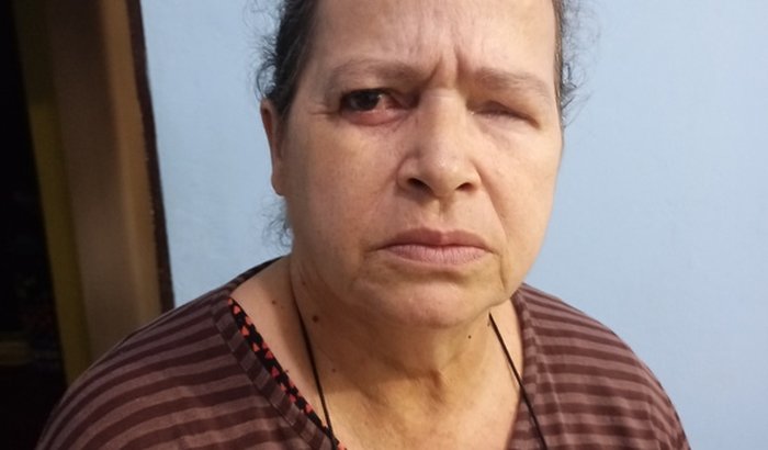 S.o.s Sandra cirurgia para enchergar 