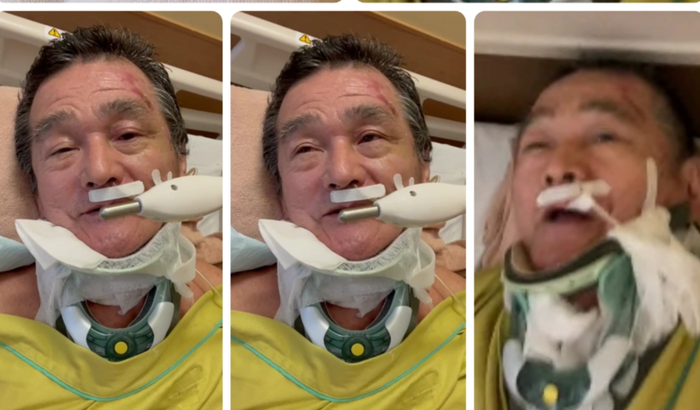 Ajuda de custos no tratamento de lesão medular