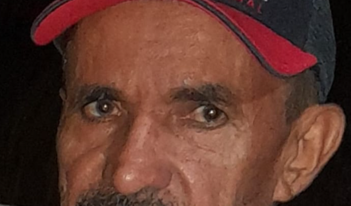 Cirurgia dos Olhos - Catarata Bilateral