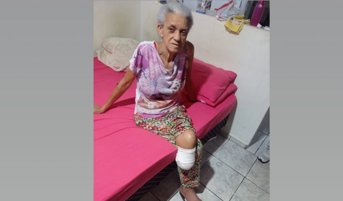 Comprar uma prótese