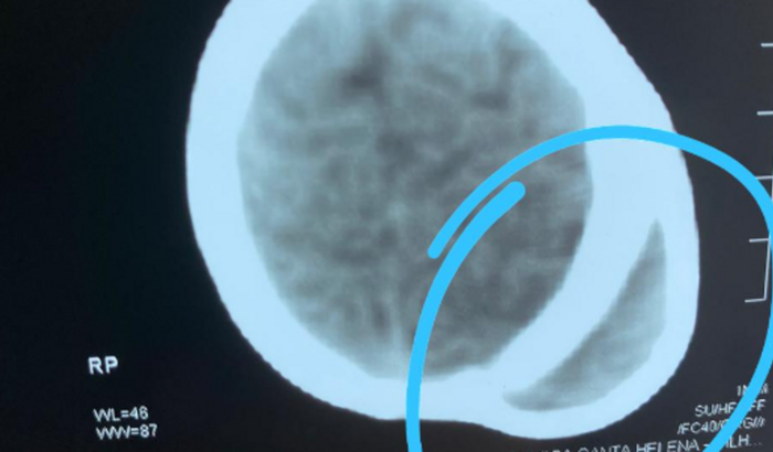 Cirurgia do Gael