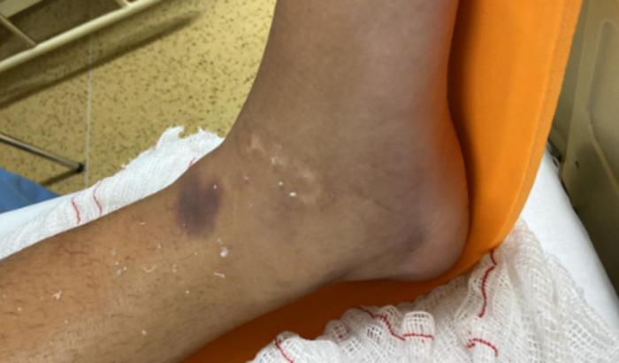 Em pró do nosso amigo Zequinha 