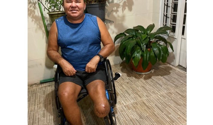 Prótese para o Francisco