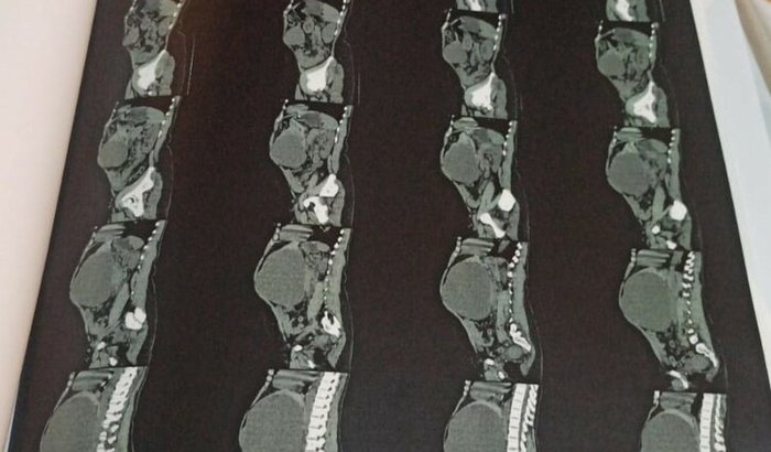 Vakinha pela vida da sirlesia que esta com um tumor no ficado