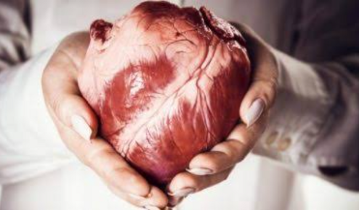  Cirurgia  coração 