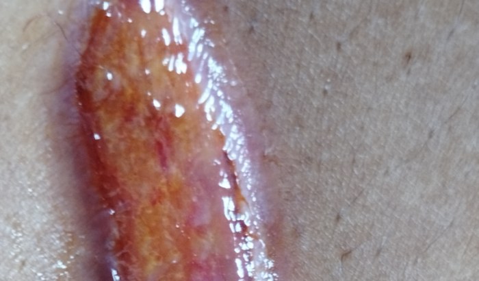 Vim fazer uma cirurgia de emergência em outra cidade , hoje preciso voltar pra minha cida , e pessoa ajuda,de todos .