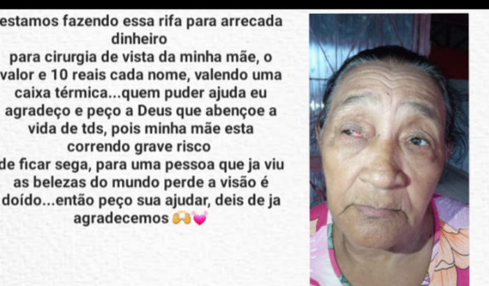 Cirurgia de olhos da minha Avó