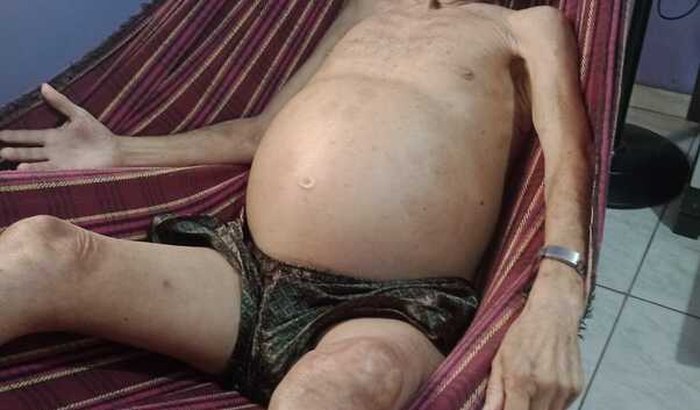 Vaquinha para custear o tratamento de Seu Manoel Raimundo 