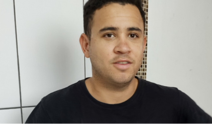 Ceratocone grave 🥺 lente escleral