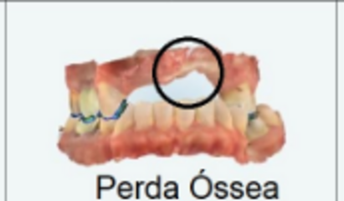 Ajuda para fazer tratamento dentário