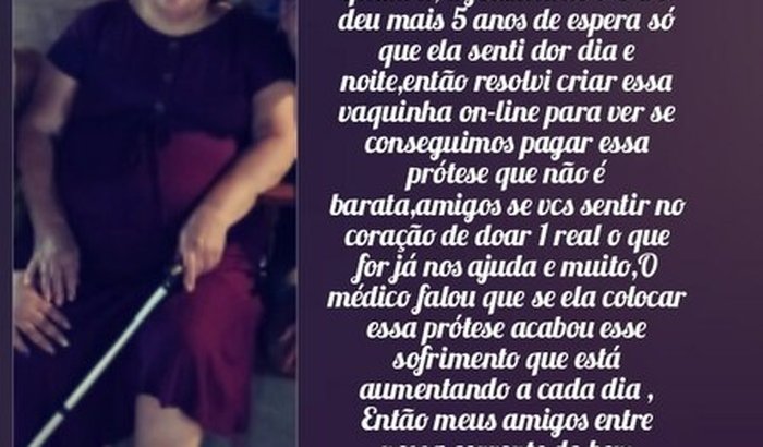 Na luta por uma prótese