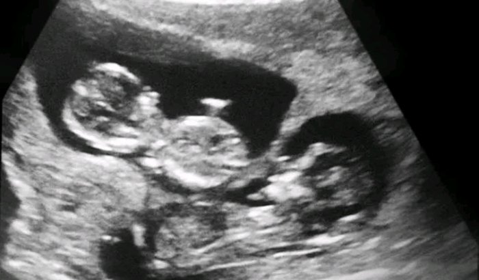 Ajuda para salvar minha gravidez 