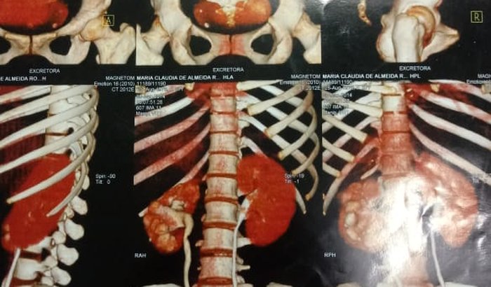 Cirurgia de urgência de Claúdia.