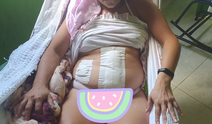 Mim chamo Adriana sofri um acidente de moto e preciso de ajudar pra compra remedios e alimentos.