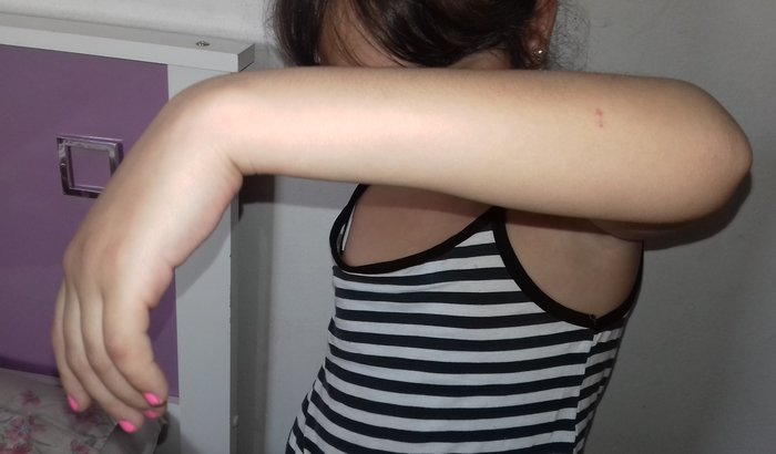 Cirurgia reparação de Nervos