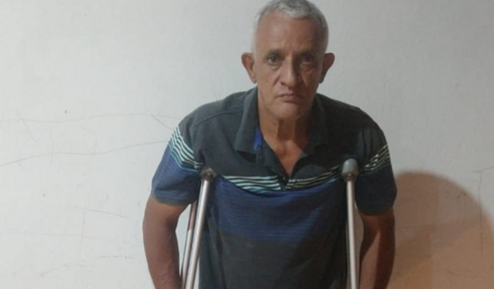 Cirurgia quadril ( prótese )