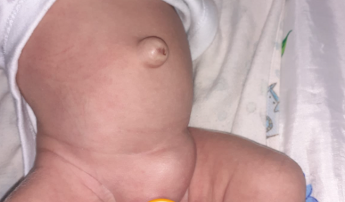 Ajuda para a cirurgia do meu filho Asafe