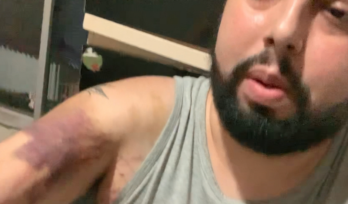 Salve minha vida! Câncer, Linfoma Exame