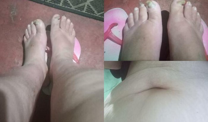 Exame doppler e outros demais