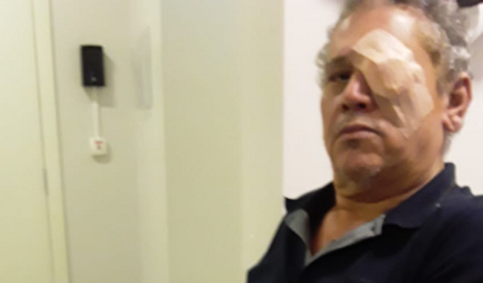 Cirurgia Adão Claudinei