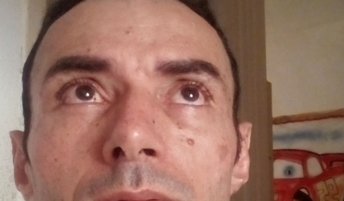 Saude visual( olho direito  e olho esquerdo)