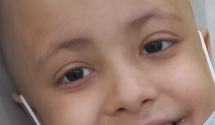 tratamento câncer leucemia