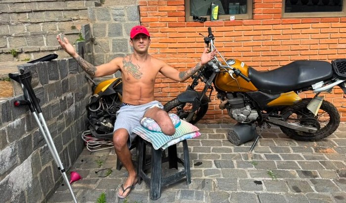Me Ajuda Compra minha Perna Mecânica