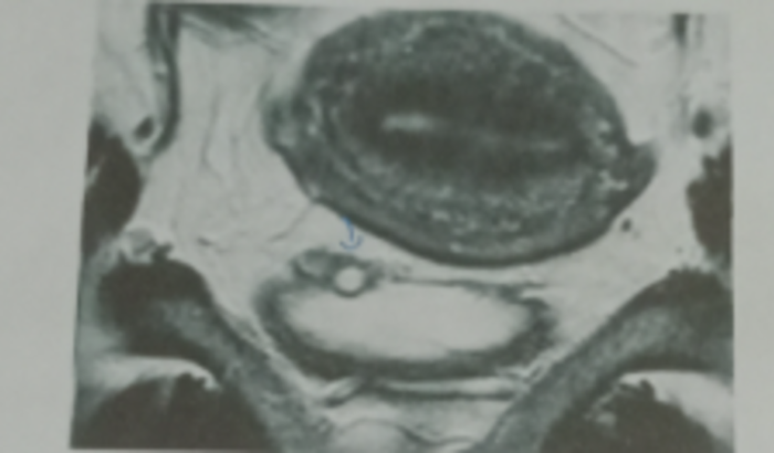 Ajuda pra fazer uma cirurgia de urgência