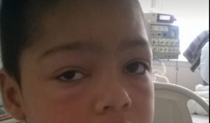 Autismo aprendendo a conviver com o invisível 