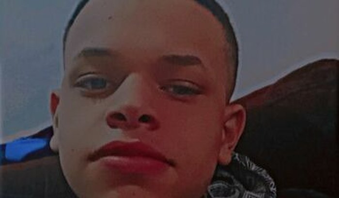 Ajua para walafe Lente de grau rígida para seratocone