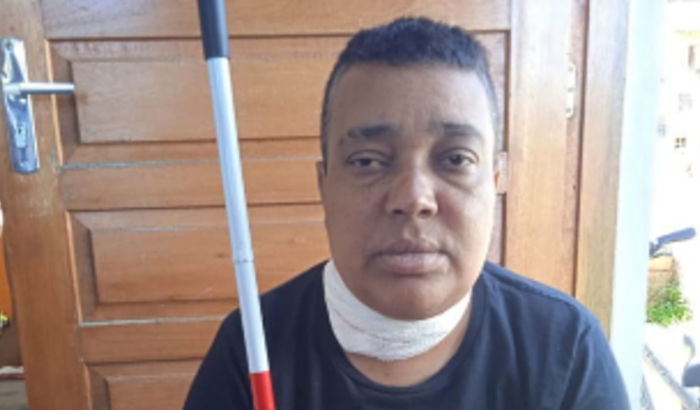 Ajuda para o transplante de fístula