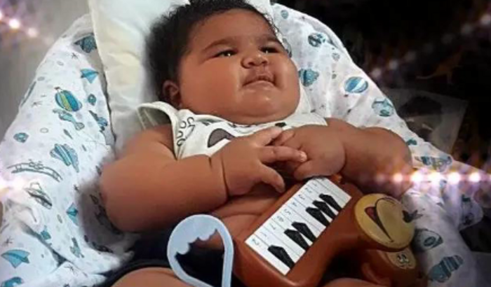 Oi sou Bruno Gabriel, sou um bebê de 8 mês e estou precisando fazer uma ressonância do crânio