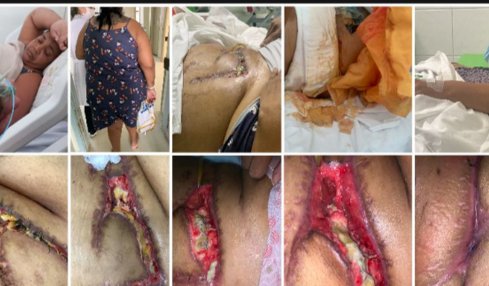 Ajuda para Katia ( ERRO MÉDICO)