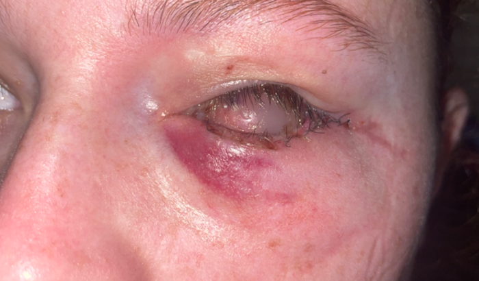 PAGAMENTO DA CIRURGIA